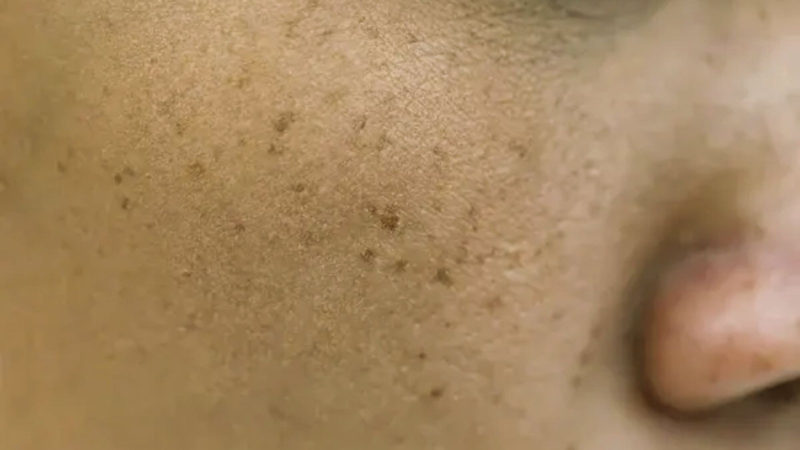 A woman's face in close-up, highlighting her freckles and expressive features.