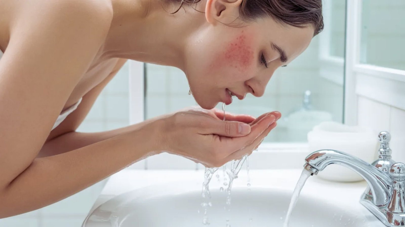 Why Does My Face Burn