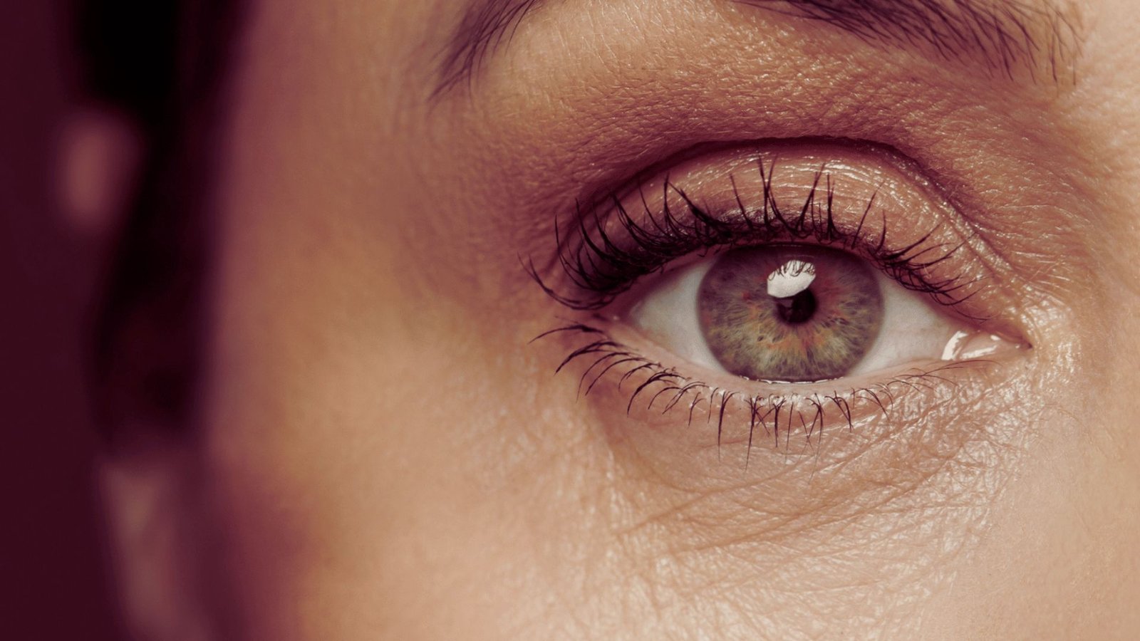 Do People With Alopecia