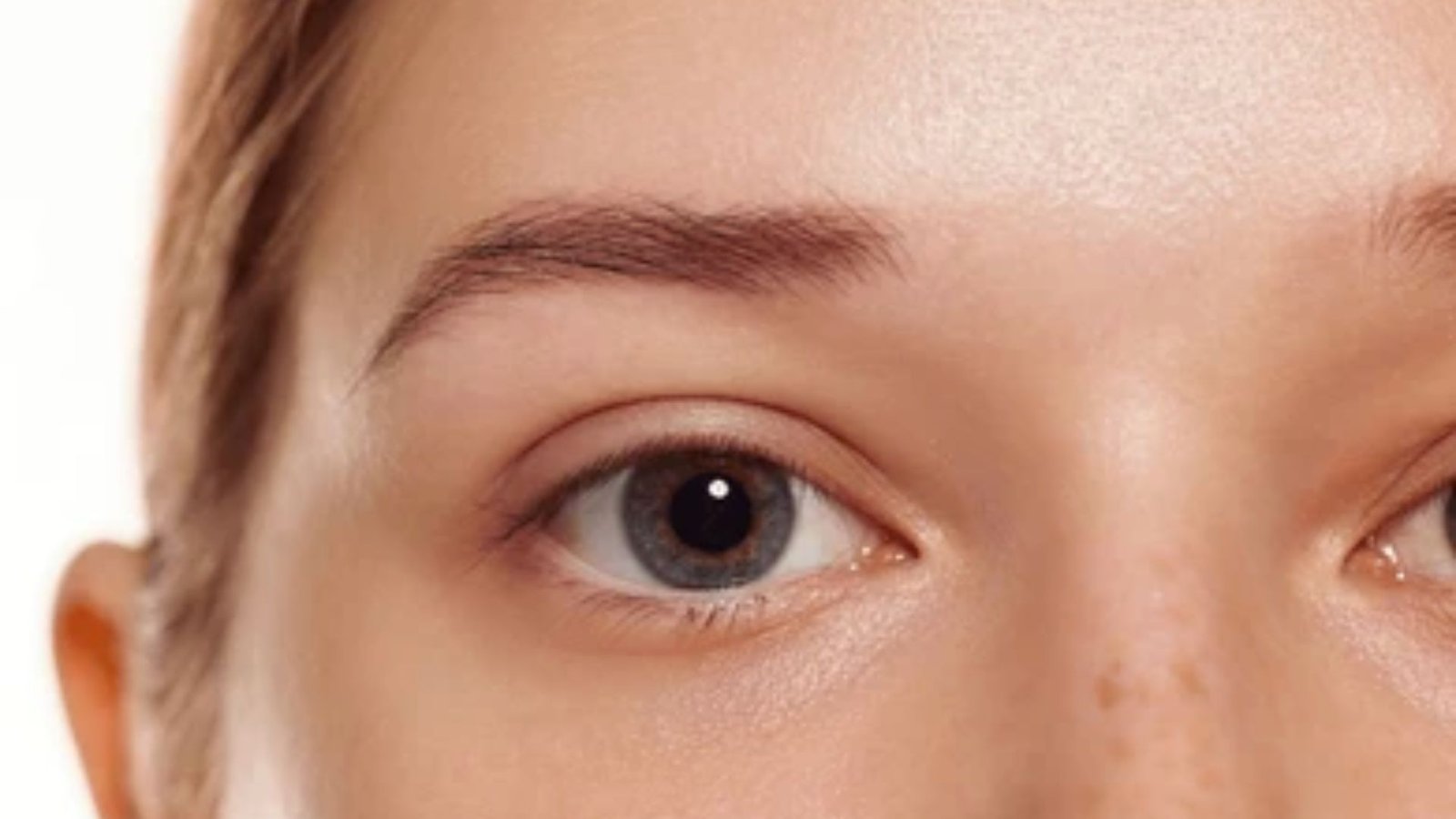 How Alopecia Affects Eyelashes
