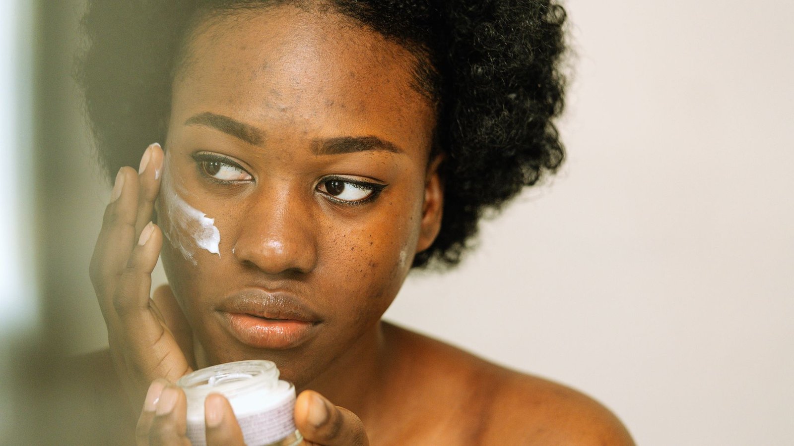 Can Moisturizer Cause Acne