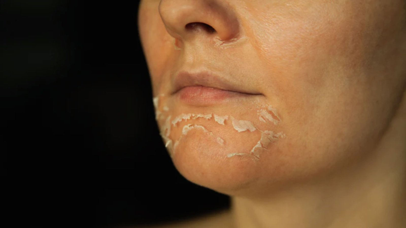 A woman with a distinctive white patch on her face, showcasing her unique beauty and individuality.